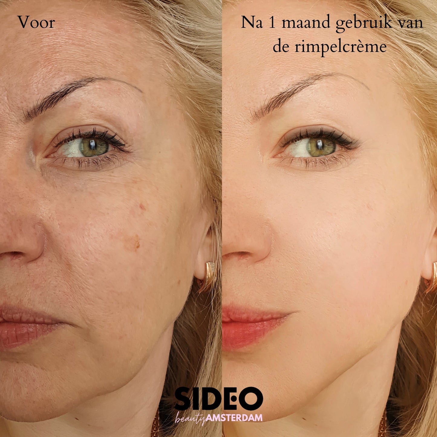 De Virale Instant Anti-Rimpelcrème