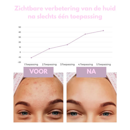 Sideo HydraLab – Intensieve Reiniging voor een Perfect Schone Huid