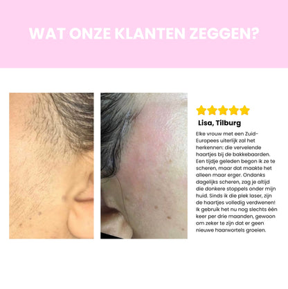Sideo IPL Haarverwijderaar – Professionele laserontharing voor thuisgebruik
