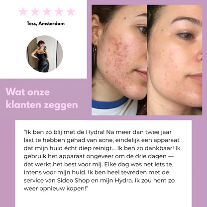 Sideo HydraLab – Intensieve Reiniging voor een Perfect Schone Huid