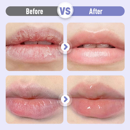 Opvullend en Anti-Rimpel Hydraterend Lippenserum